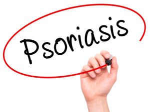 Caregiver in Reston VA: Senior Psoriasis Care